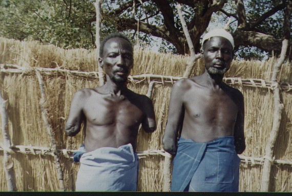 War victims in Sudan